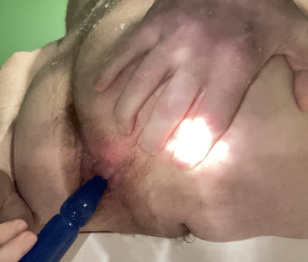 Hairy prolapse hole for you to play. Beautiful manpussy.
