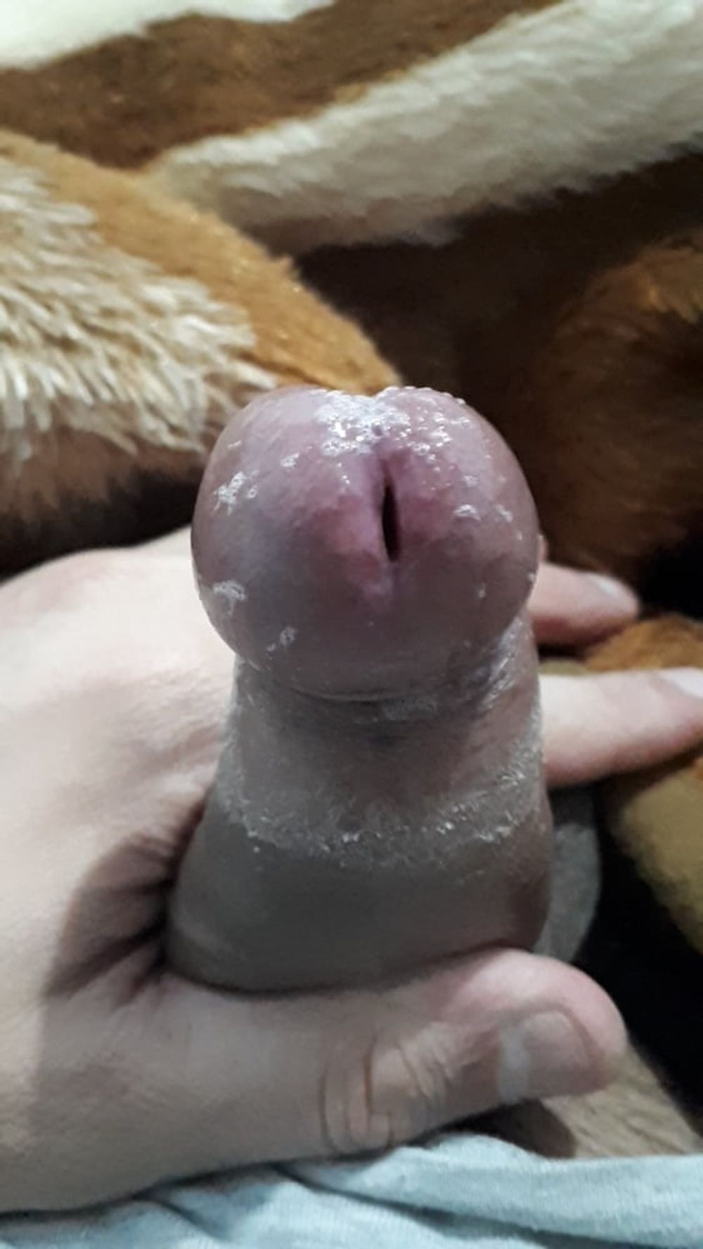 WetForeskin #12