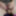 Young Chubby Girl Spreads Hairy Pussy Open on Webcam #24