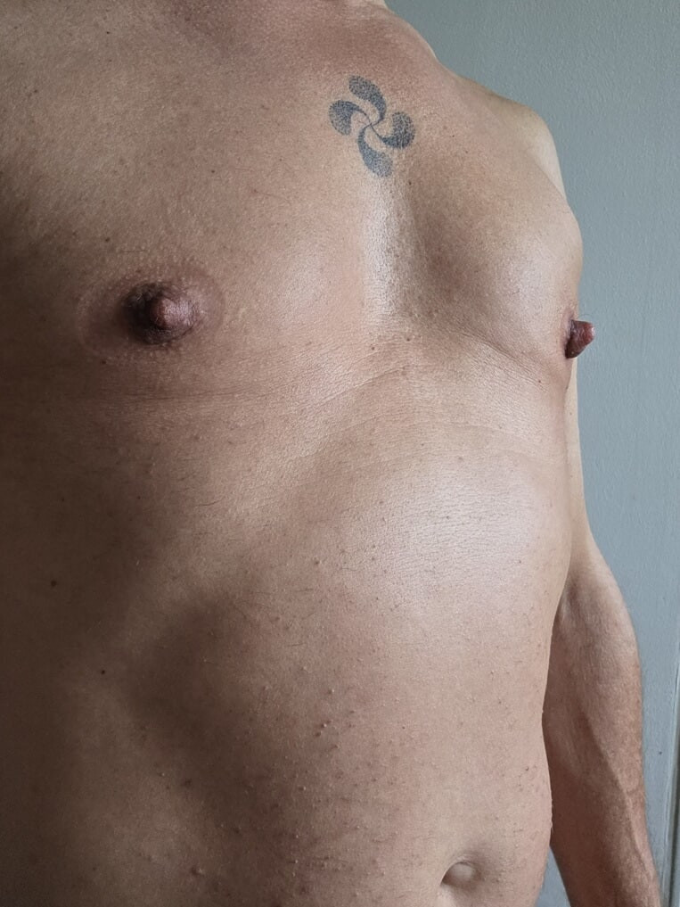 NIPPLES PUMPED 5 #22