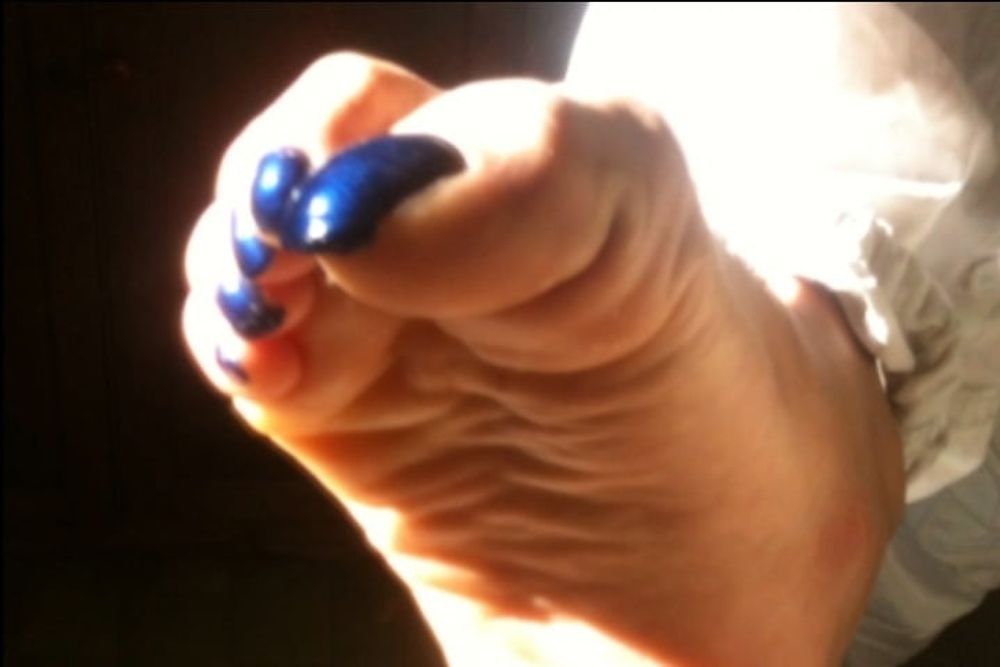 Blue toenails under sun ray #19