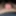 Close up foreskin and glans #6
