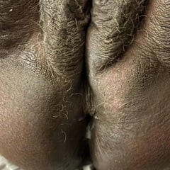 Anal Action
