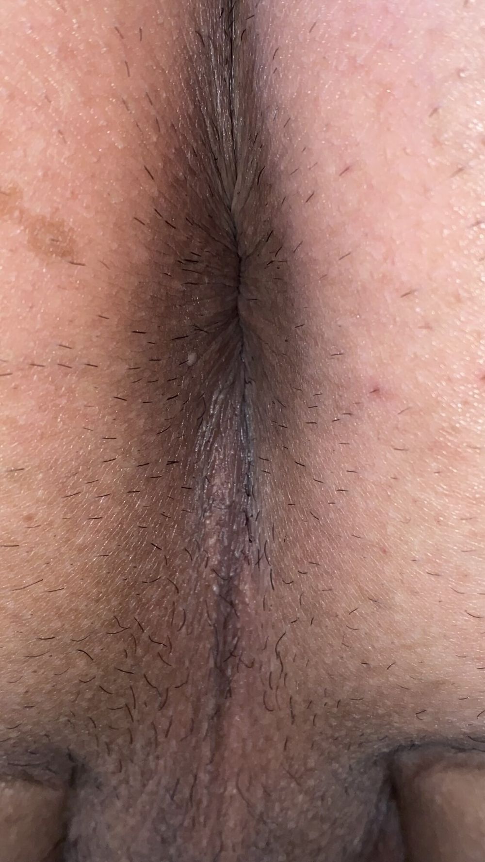 An image of my anus that is clear to every single wrinkle #54