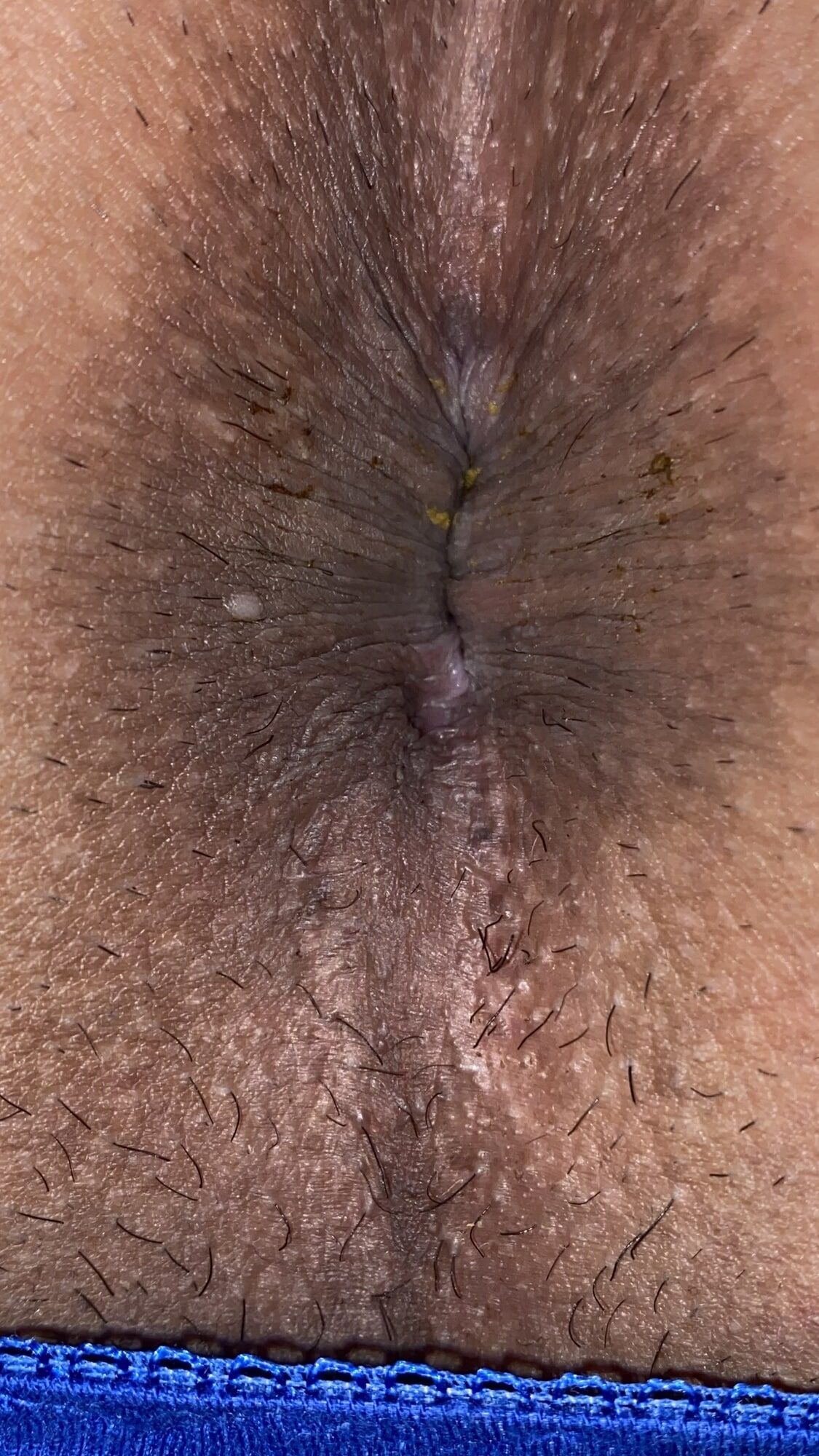 An image of my anus that is clear to every single wrinkle #13