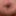 My foreskin #5