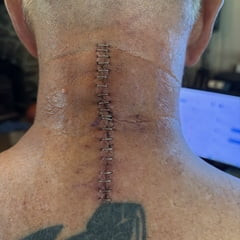 surgery