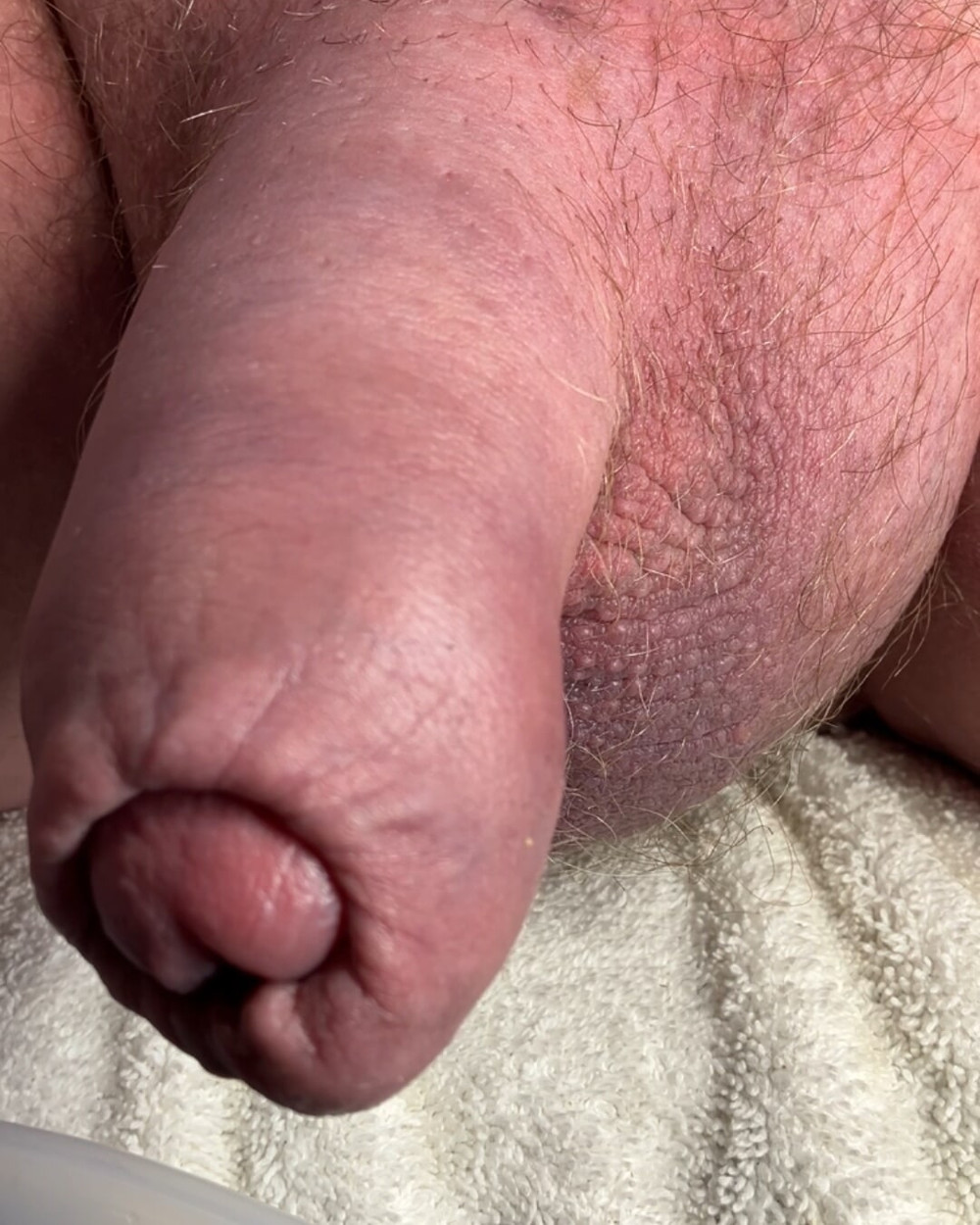 Compilation of uncut cock pics #18