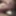 Tugging my foreskin - Foreskin restoration - Aug 2025 #4