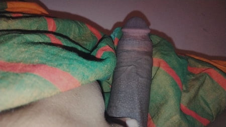 Dick is swollen and the veins are sticking out