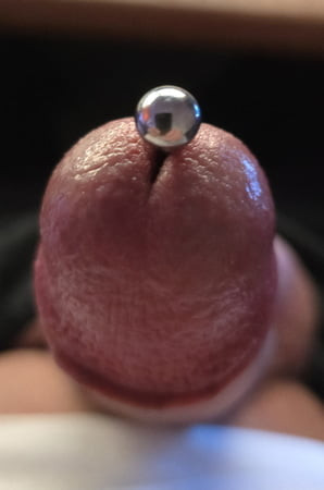 扩张器