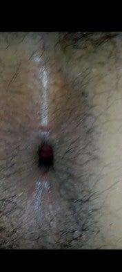 Ass hole #3