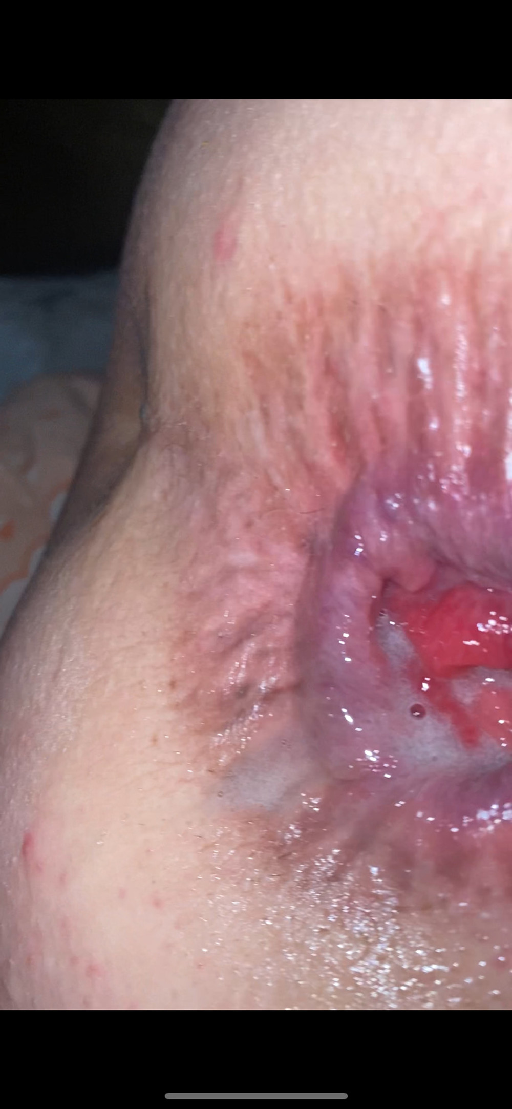 Sexy anal squirt couple