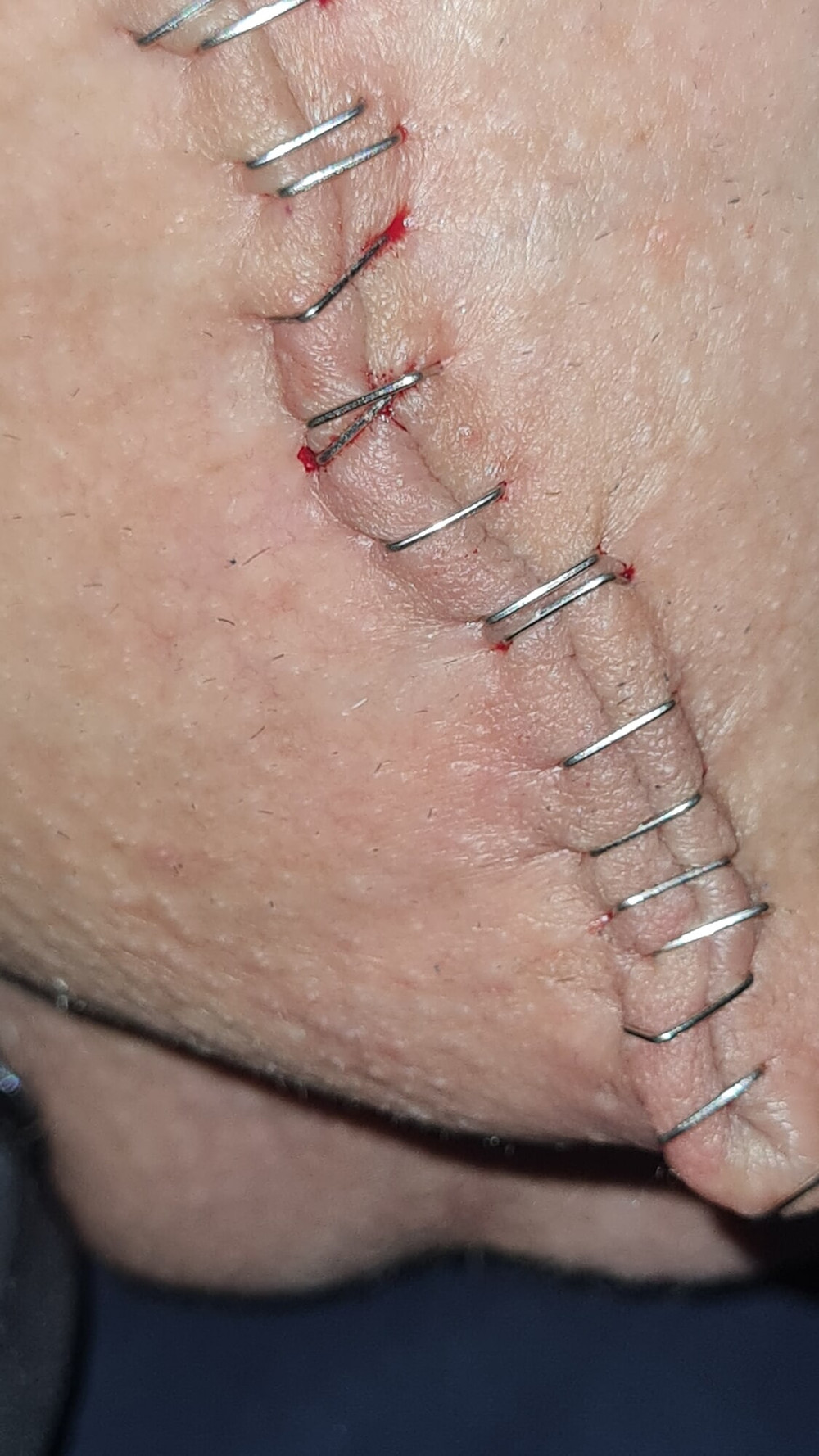 Stapled cock and balls #8