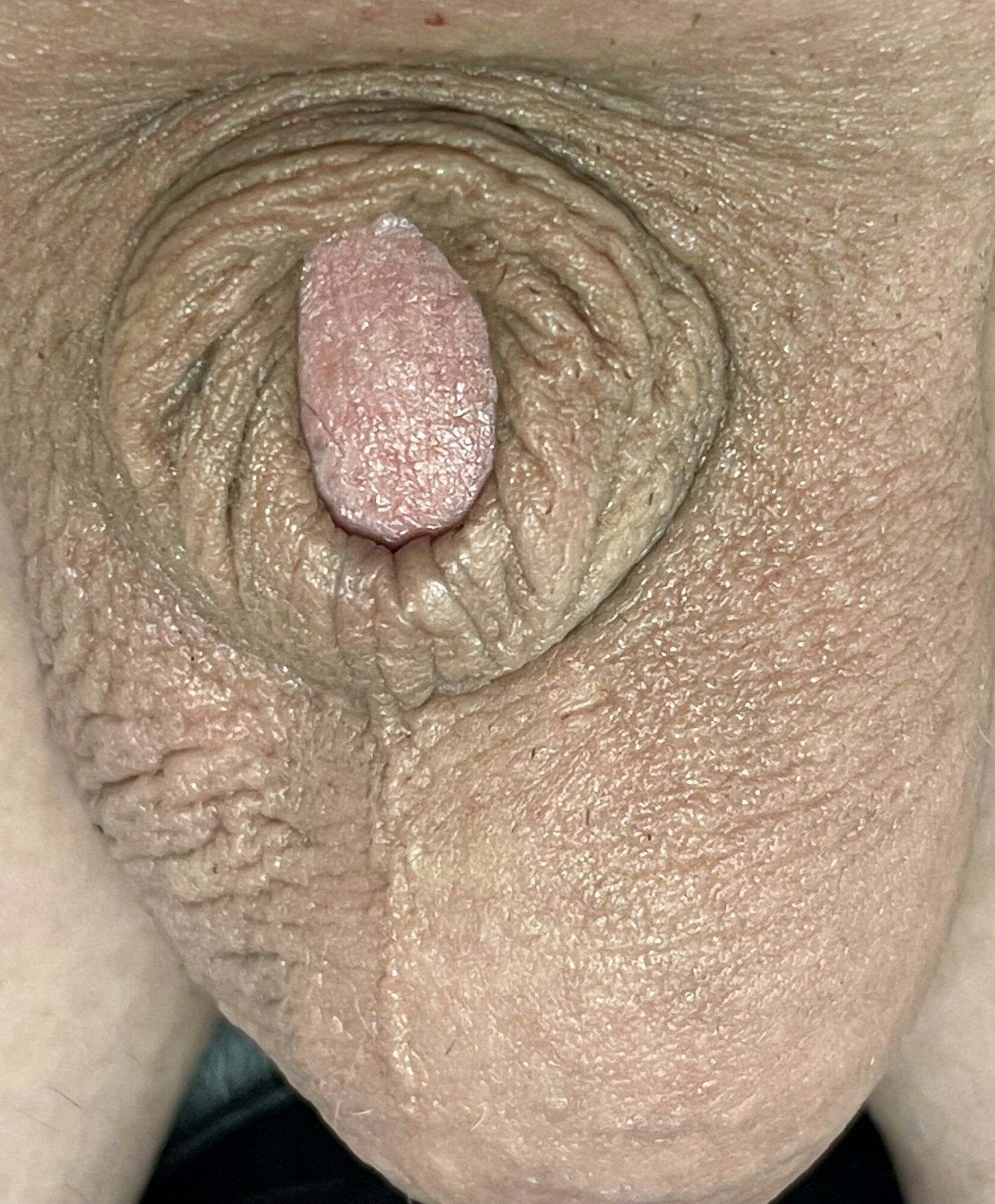 Micropenis close up #12
