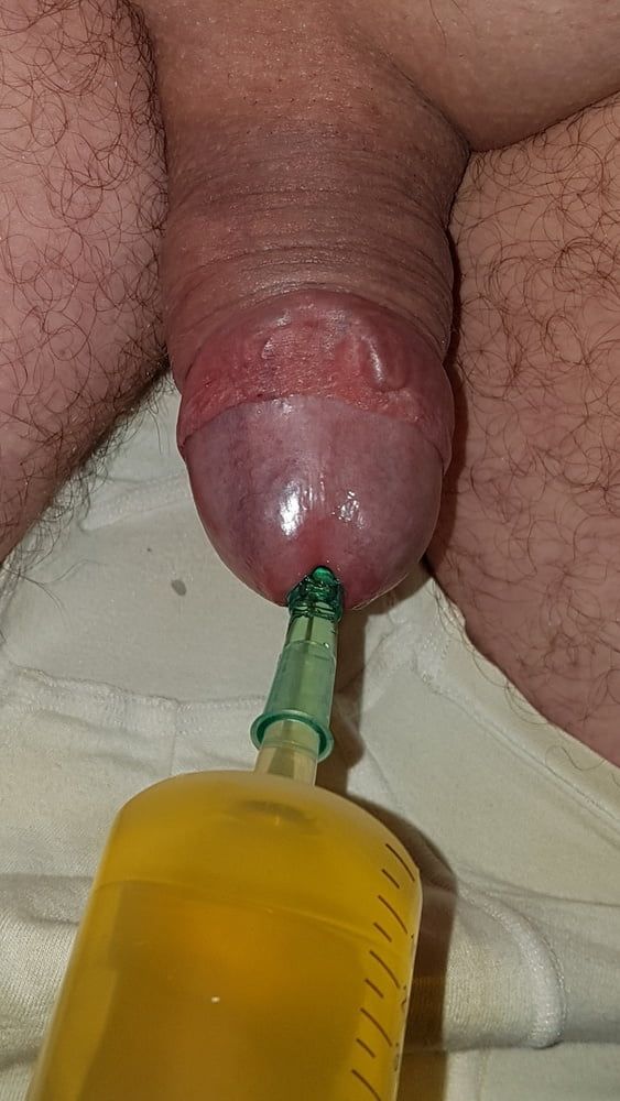 Catheter sounding with my urine #35