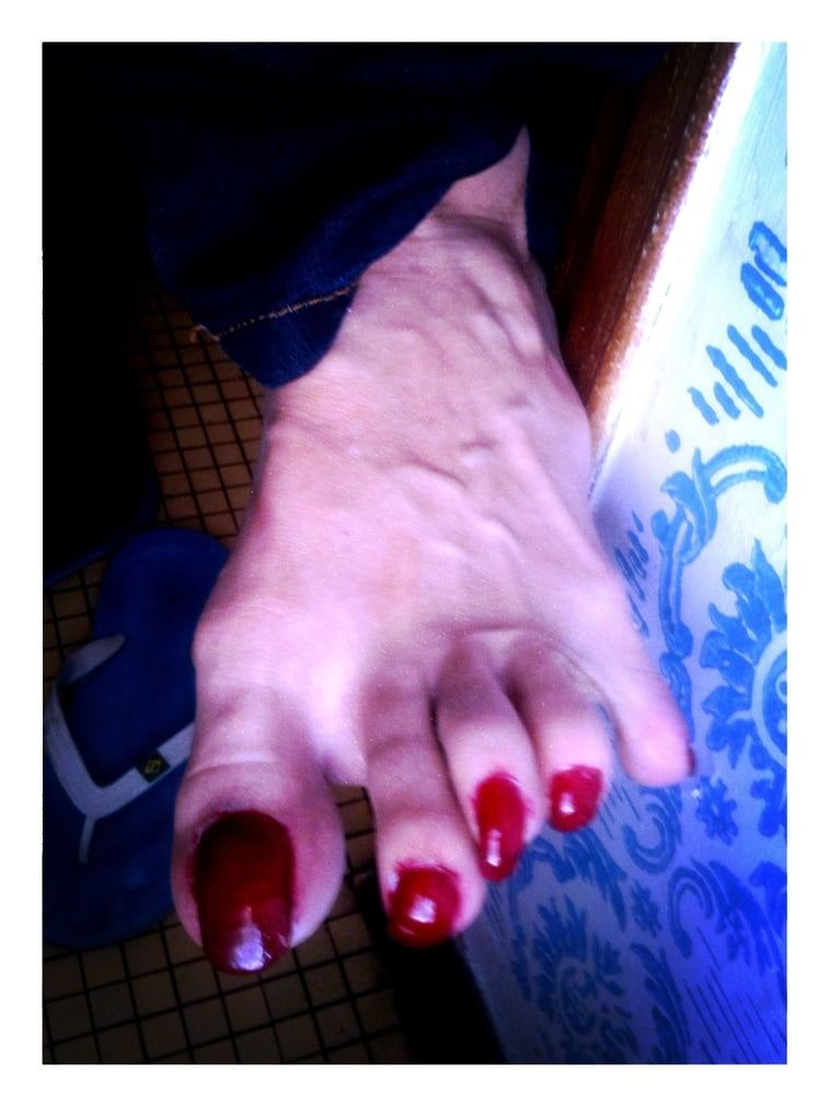 Asian ts feets, soles, toenails mix #22