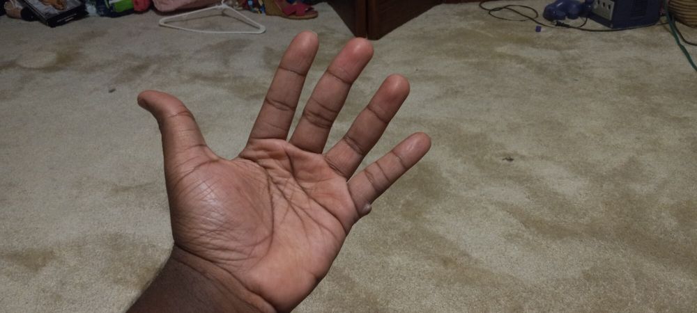 Pics of my Hands #24