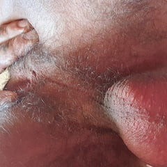 Penis