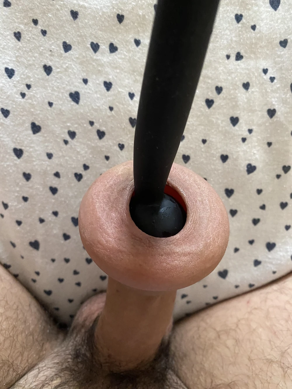 Extreme foreskin inflation #3