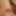 Tiny Cock Micropenis Small Dick
