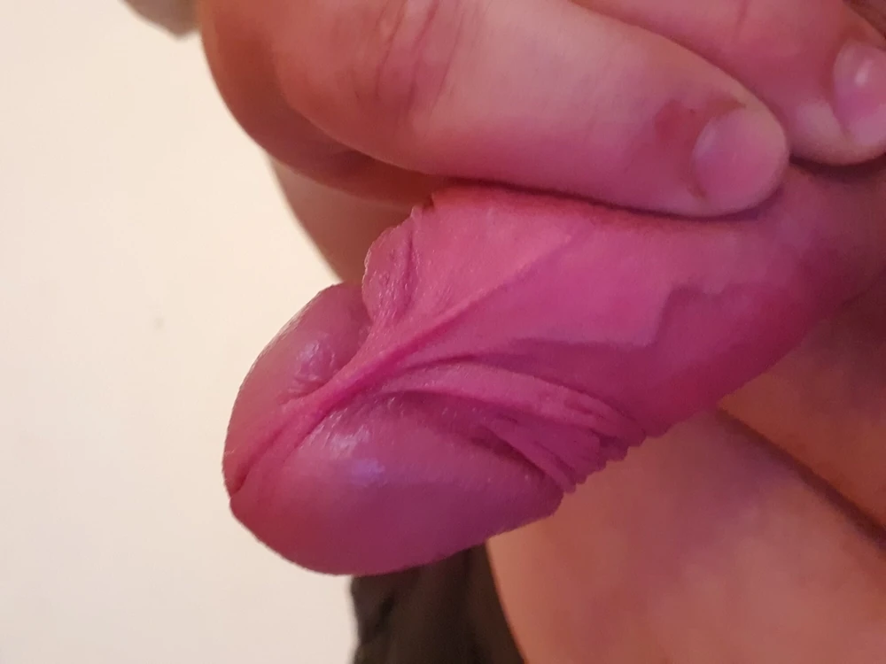 Penis #2