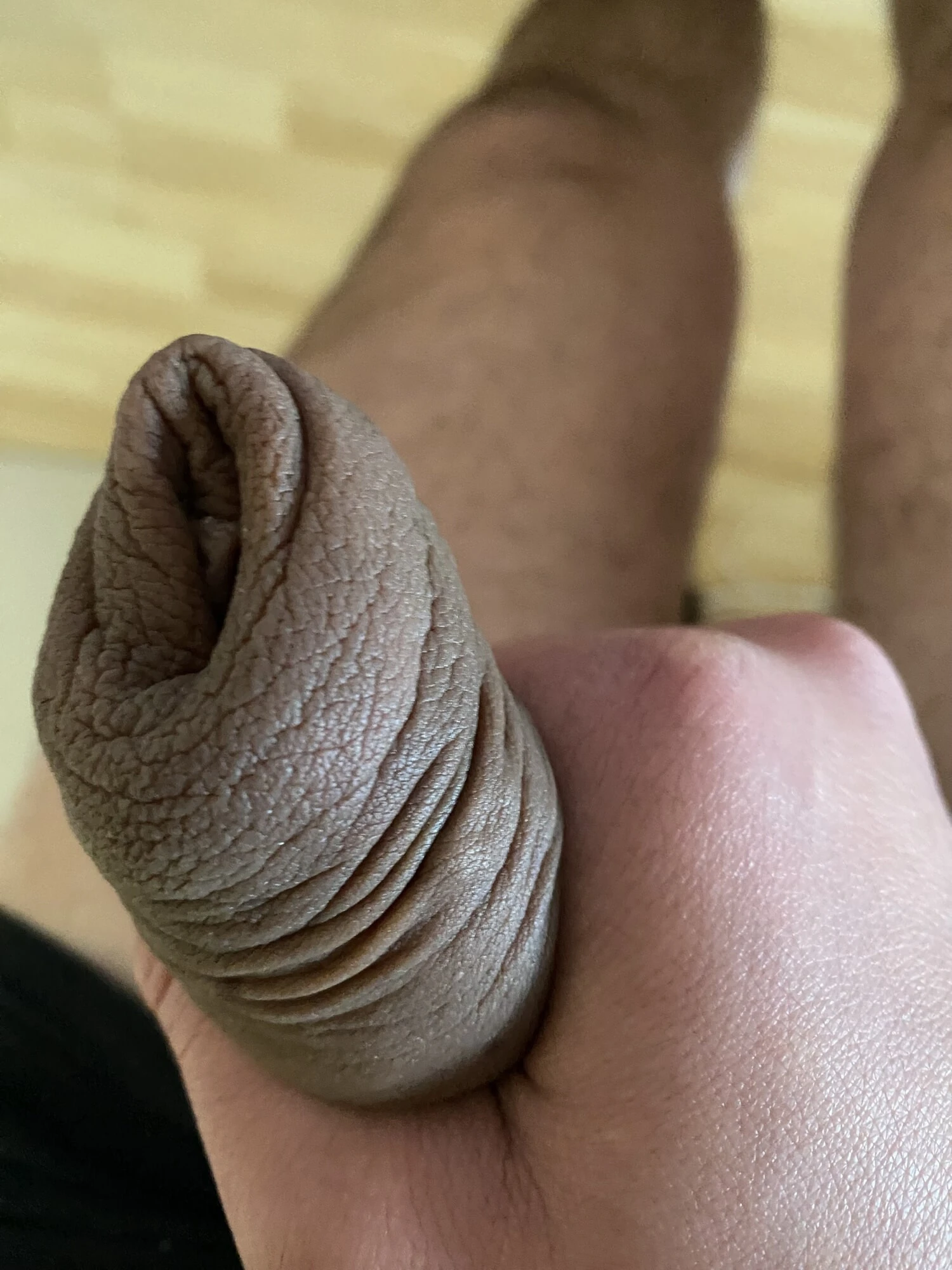 Extreme foreskin stretching porn