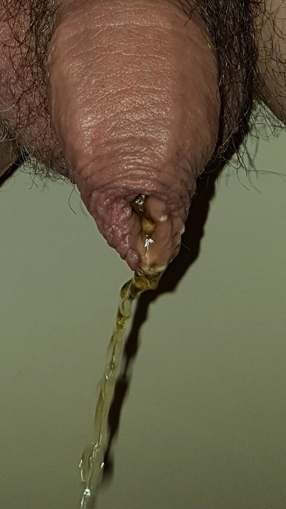 My foreskin #3