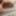 Foreskin overhang and loose porn