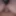 tiny phimosis foreskin dick 