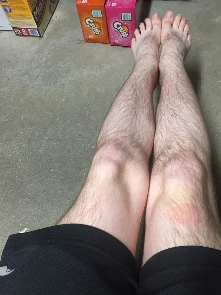 Pictures of Me and my Body #45