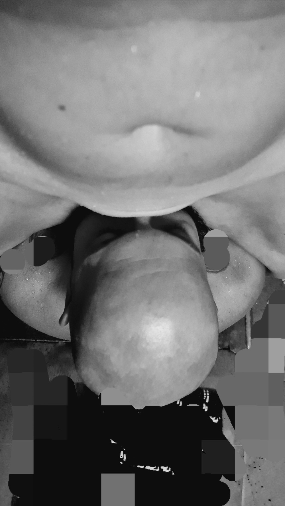 Ich #2
