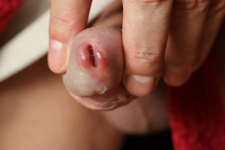 Mój peehole