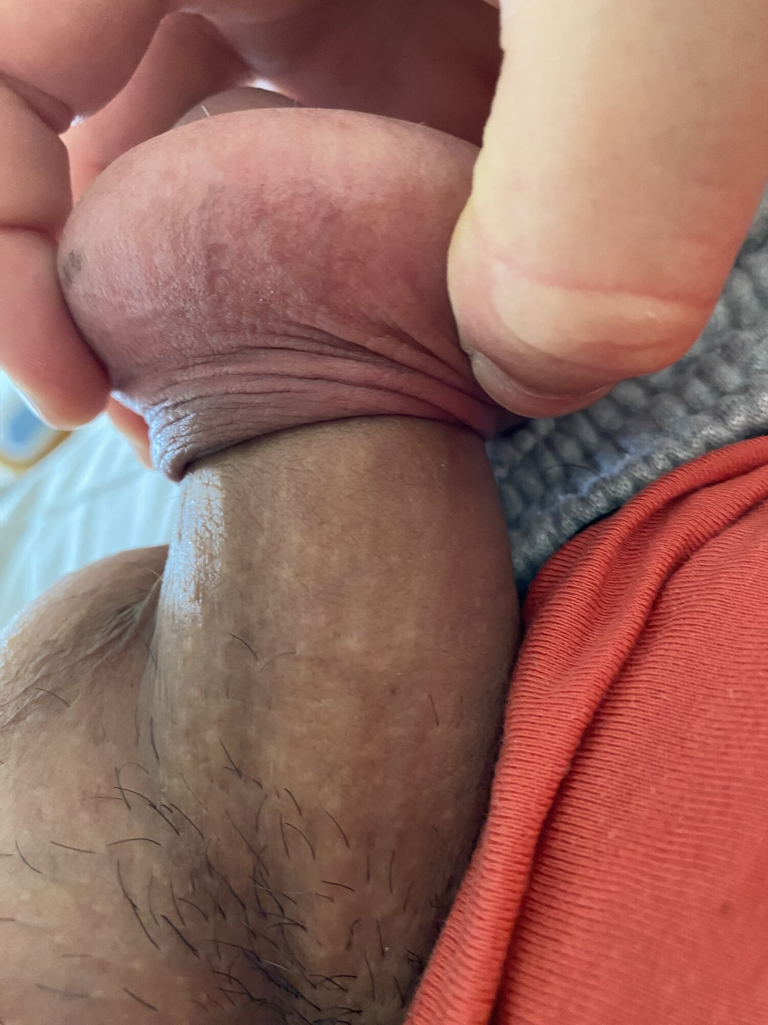 Foreskin extreme stretching porn 