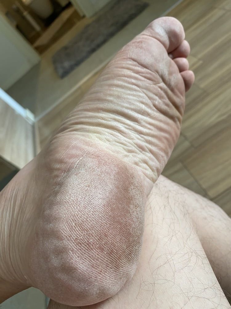 My close-up feet and soles