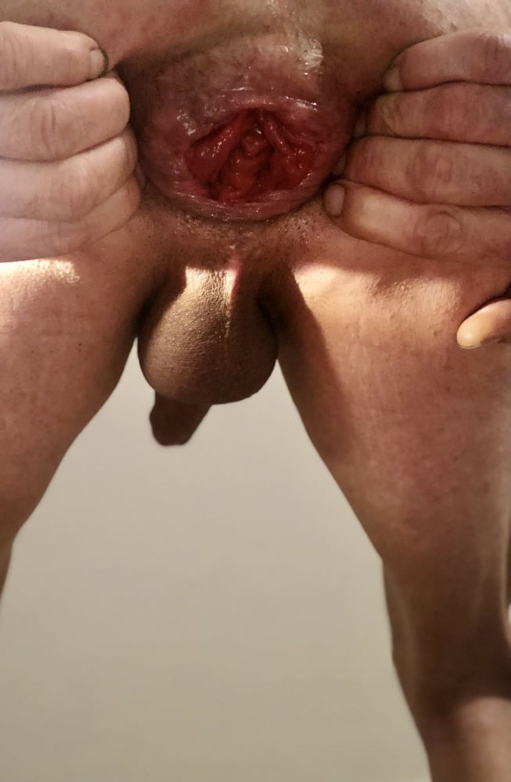 anal dilation after big insertion #25