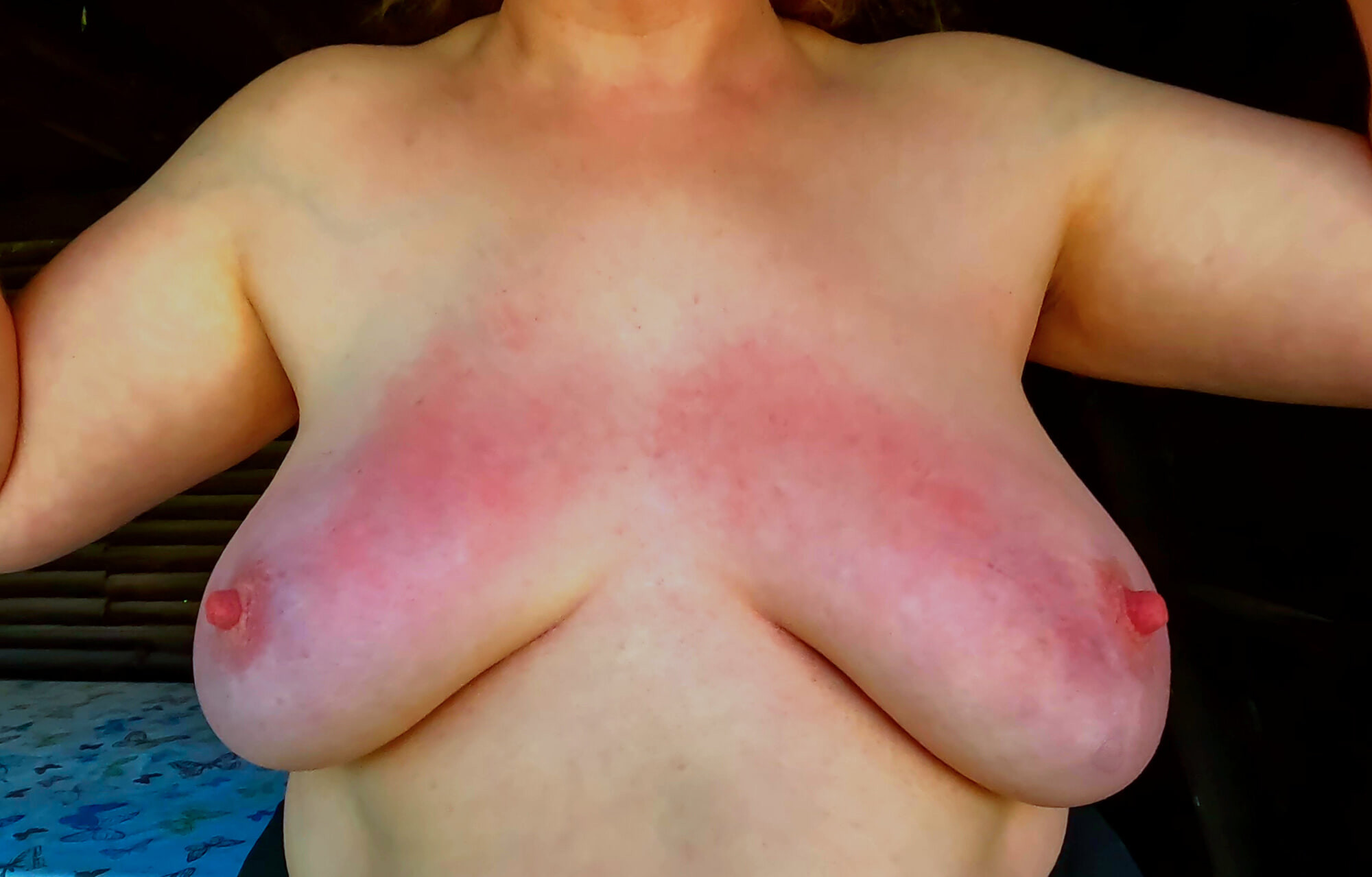Tites before - after slapping