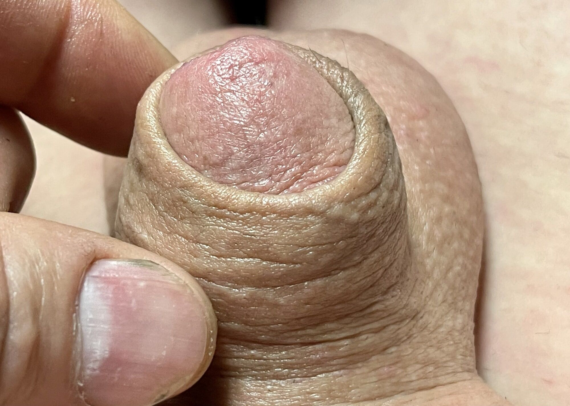 Micropenis close up #6