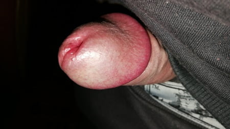 my thick penis head with my big pee hole