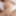 Teaser
