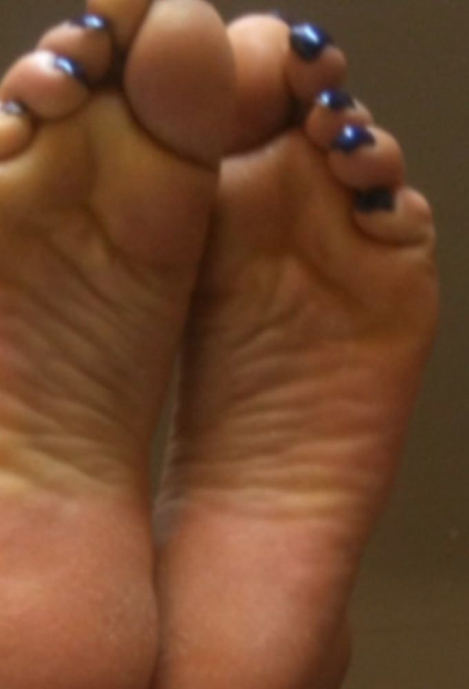 blue toenails and soles feet after day at beach  #39