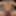 Full frontal erection