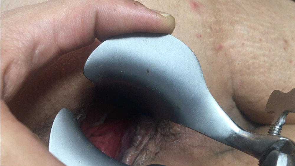 Goldenboy Anal Gallery 1 #14