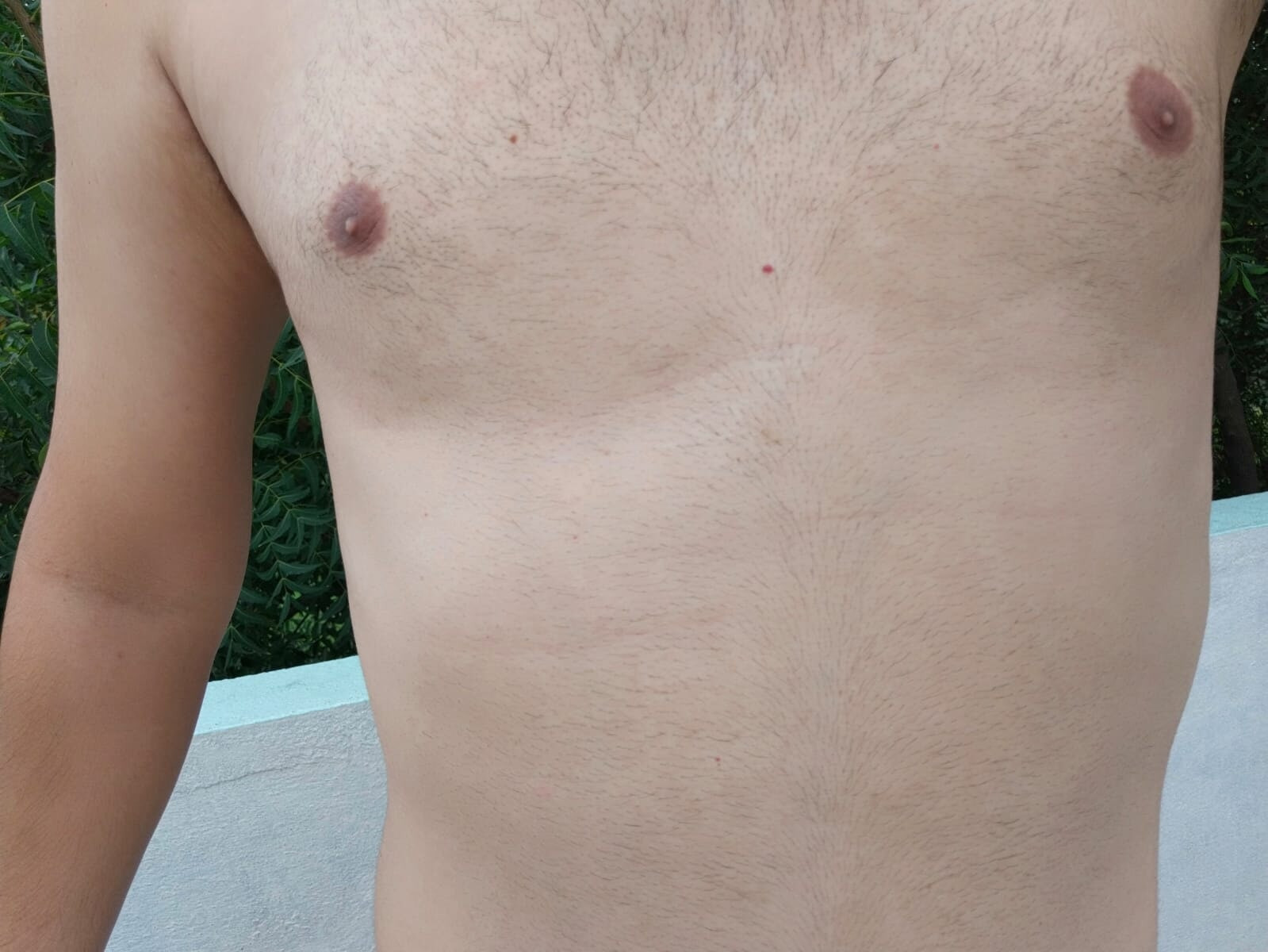 male nipple