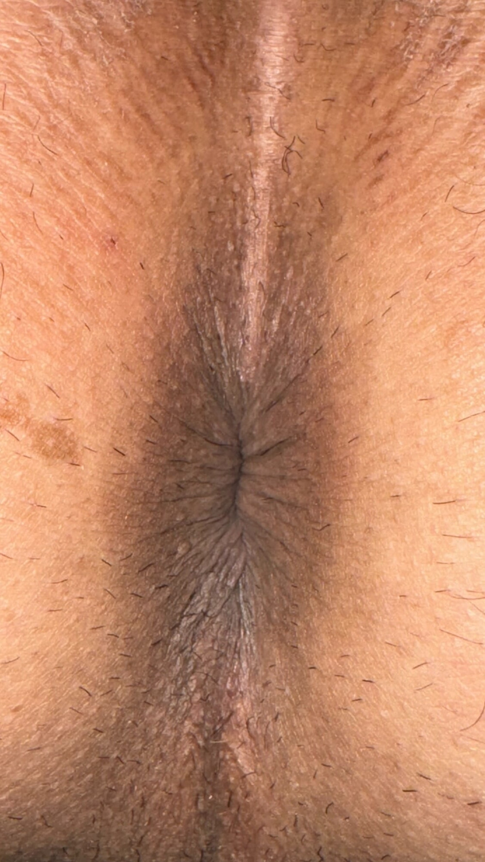 my  anus #7