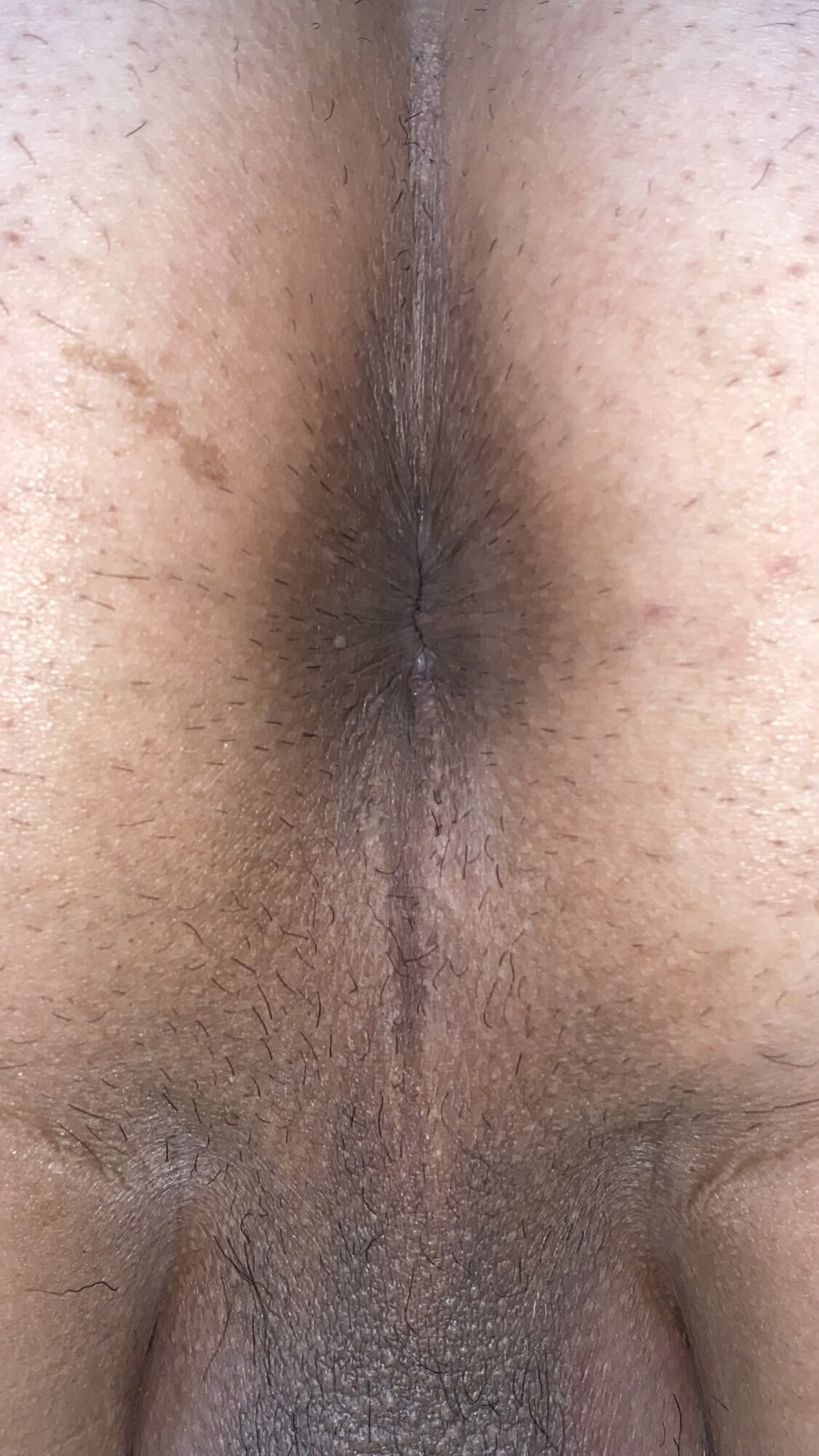 An image of my anus that is clear to every single wrinkle