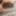 Foreskin overhang and loose porn