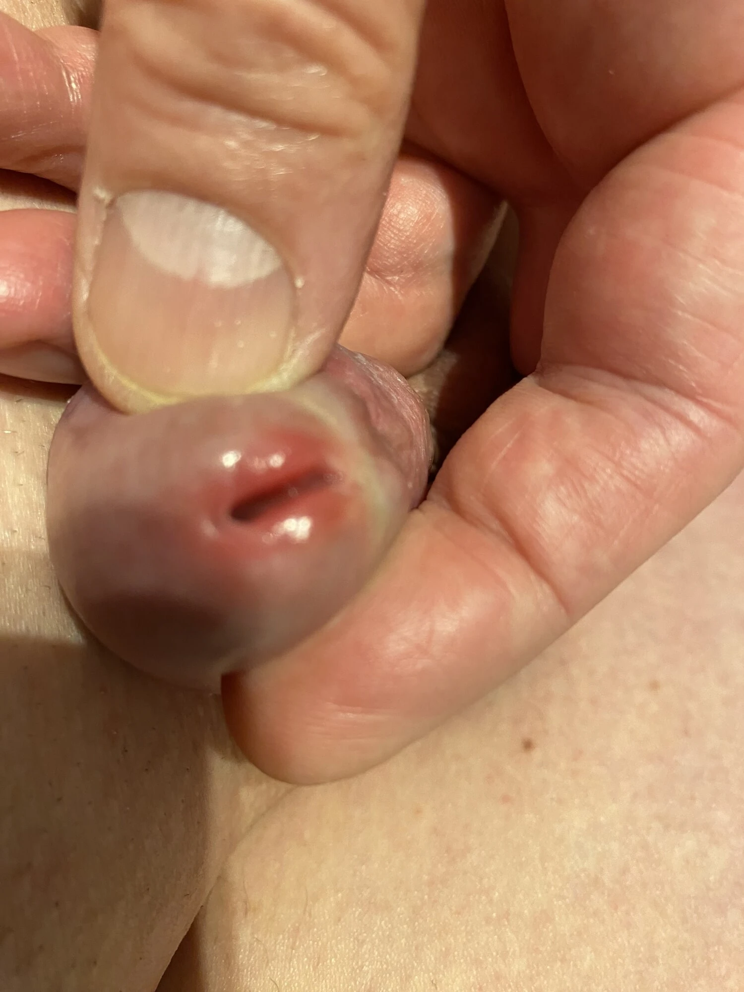 My Micro dick