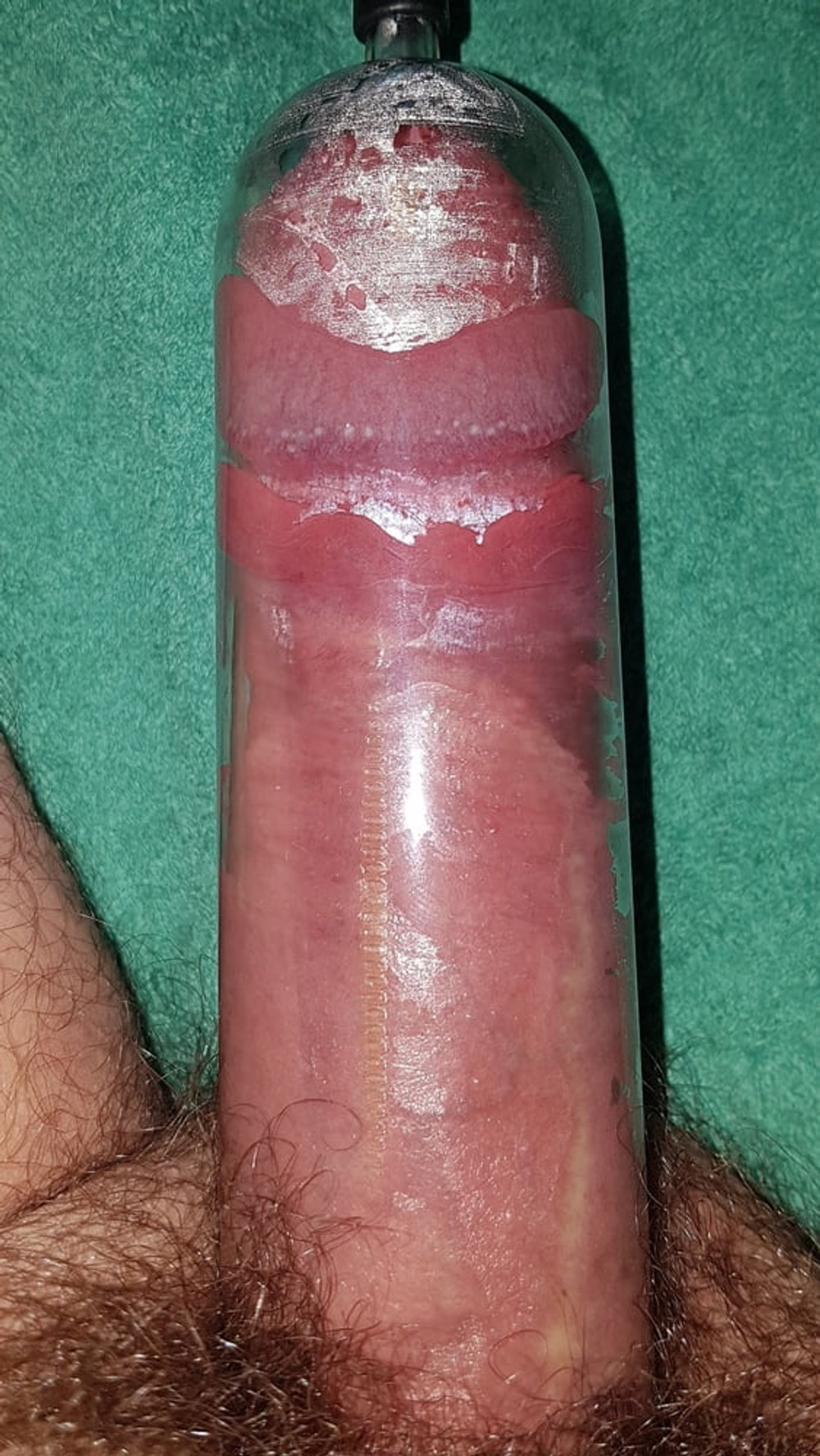 Penis pump #25