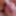 Urethra play and syringe close up photo&#039;s 